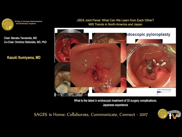 The latest in endoscopic treatment of GI surgery complications: Japanese experience