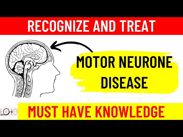 What is Motor Neuron Disease (MND) | All you need to know | Causes | Symptoms | Diagnosis |Treatment