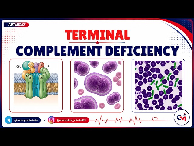 101. Terminal Complement Deficiency Explained | C5–C9 Deficiency, Neisseria Infections & Management.