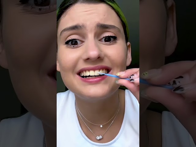 ¡Atención! APRENDE a ponerte los brackets en casa fácilmente (Si quieres DESTROZAR TUS DIENTES)