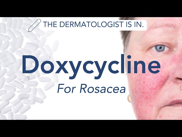 How Doxycycline Treats Rosacea: Benefits, Dosage, and Side Effects | Dermapedia