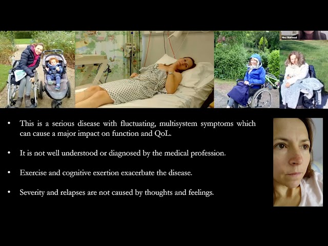 Medical Education Webinar: Myalgic Encephalomyelitis - Diagnosis, Management and Current Research
