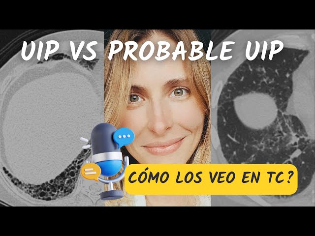 Can you differentiate between UIP and probable UIP on a CT scan?