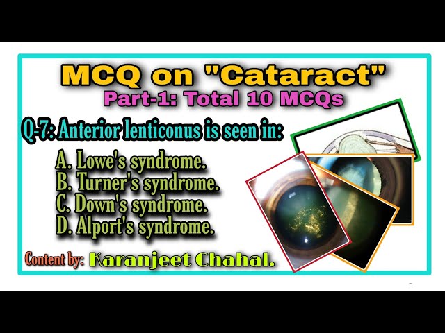 MCQ on Cataract (Part-1)