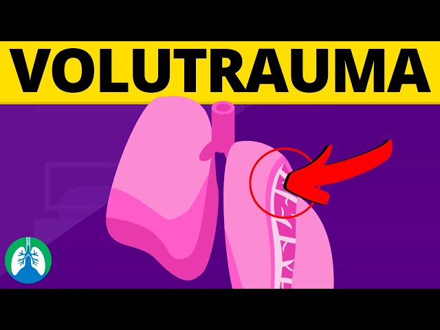 Volutrauma (Medical Definition) | Quick Explainer Video