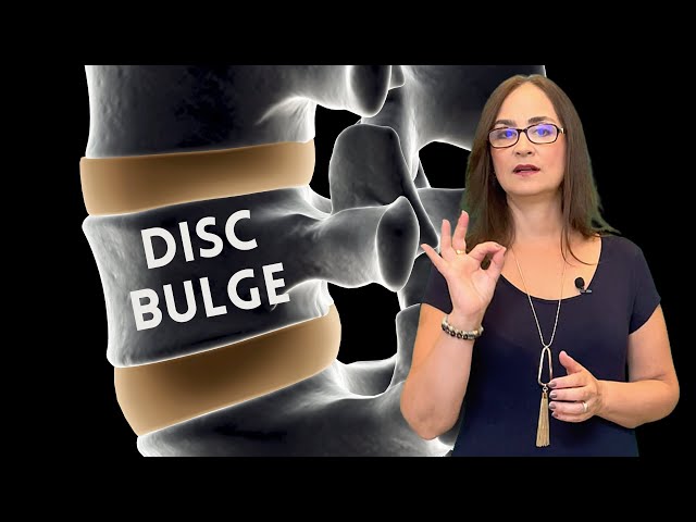 #063 Lumbar bulging disc. Is it a serious disease? Does it progress to herniation?