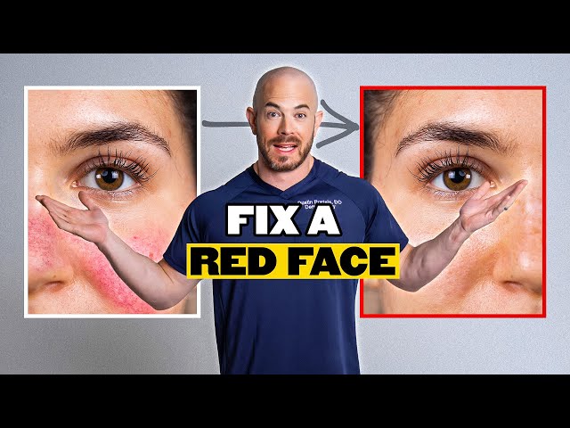Consejos de un dermatólogo experto para la rosácea y la piel sensible