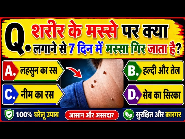 GK Question || GK In Hindi || GK Question and Answer || GK Quiz || General Knowledge Questions Video