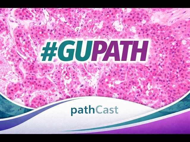 #GUPATH  GUPS and ISUP New Guidelines ForReporting of Intraductal Carcinoma of the Prostate