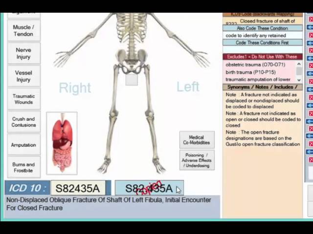 ICD 10 CM Compliance Software – Intuitive Coder
