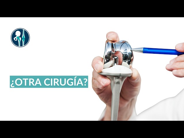 ¿Necesitas un recambio de prótesis de rodilla? Causas, síntomas y recuperación explicados