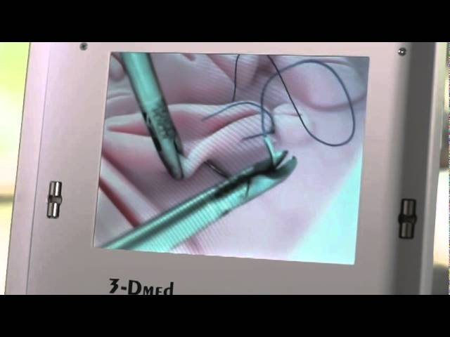 Step by Step Instructions for Laparoscopic Suturing