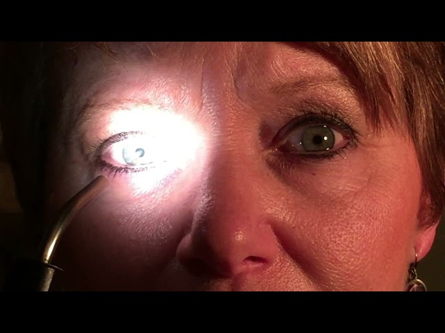 Relative Afferent Pupillary Defect (RAPD)