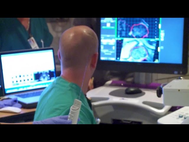 Research uncovers the best treatment for prostate cancer