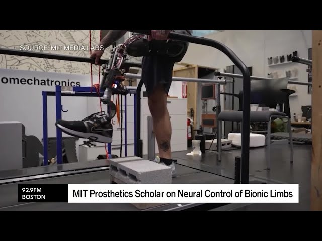 Inside the MIT Lab Building The Future of Bionic Limbs