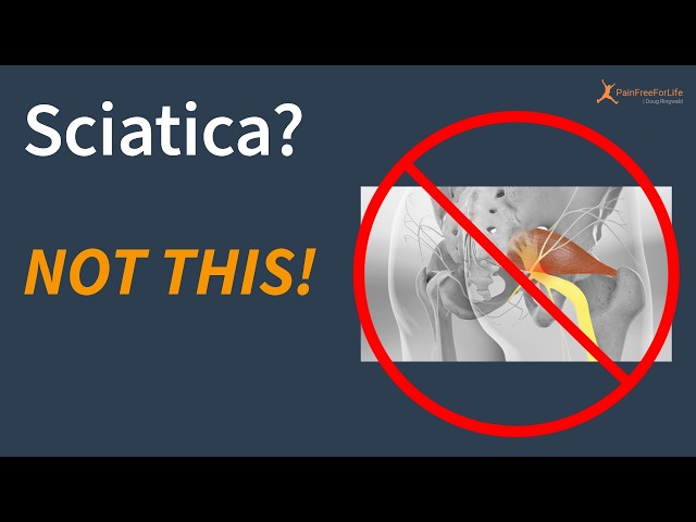 Your Sciatica Probably Isn’t Piriformis Syndrome