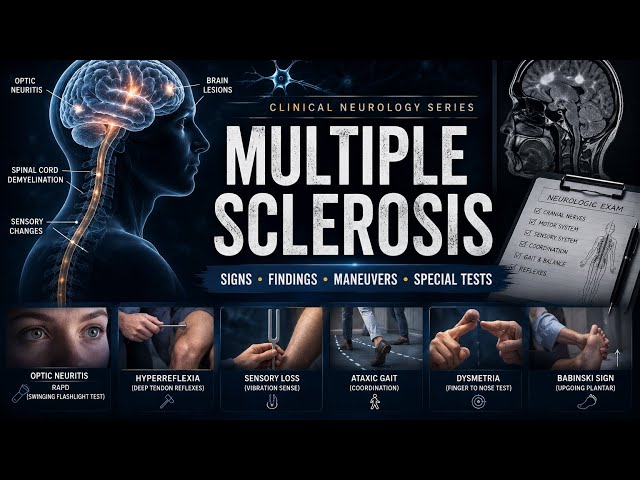 Clinical Neurology: Multiple Sclerosis 