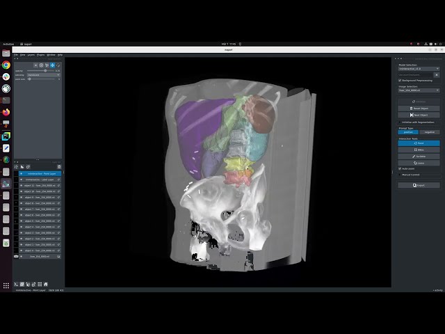 [Napari] CT organ segmentation with nnInteractive