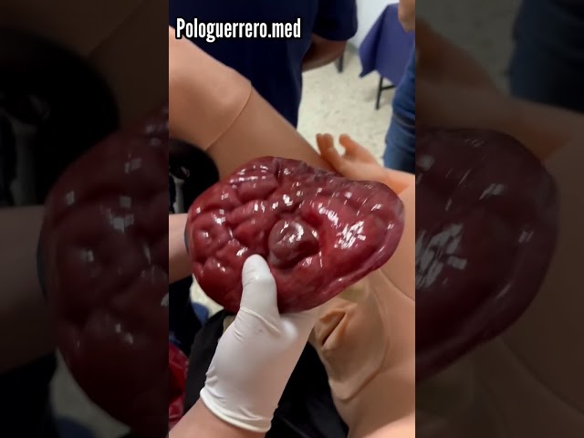 What does childbirth look like? | DrPoloGuerrero