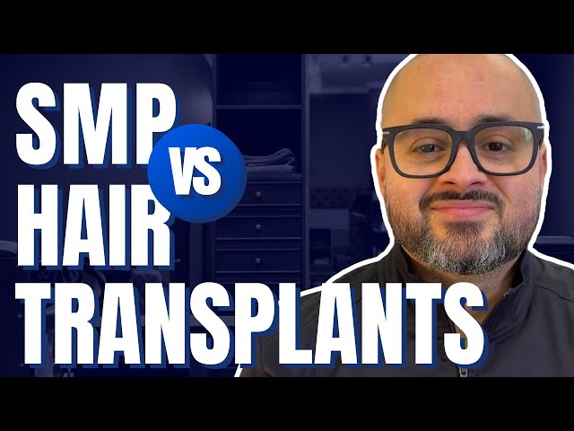 SMP vs. Hair Transplants: Which Is Right For You?