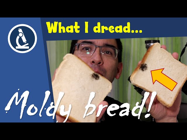 This Toast is Toast | MOLD under the microscope