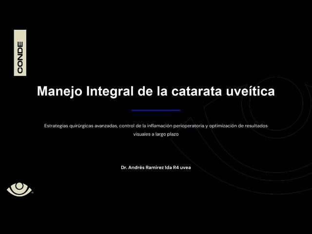 Manejo integral de la Catarata Uveítica