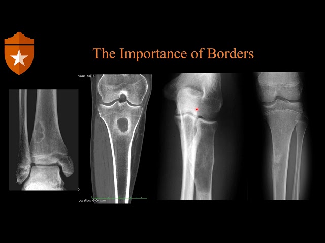 Basics of Bone Imaging