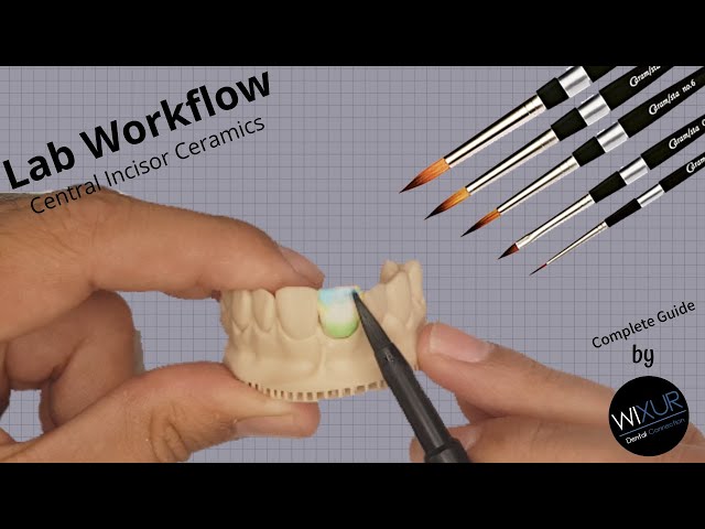 Ceramics Build-up (Layering Technique)