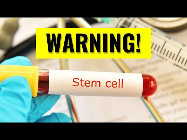 Stem Cell Therapy For Arthritis - The Truth You Need To Know