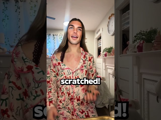 Can You DRAW On Your Skin? It’s A CONDITION!🤯