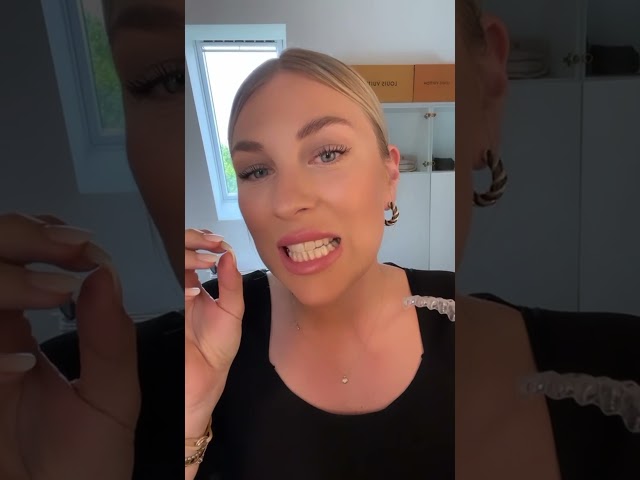 TWF you open up a fresh set of Invisalign aligners @karinagee 😍