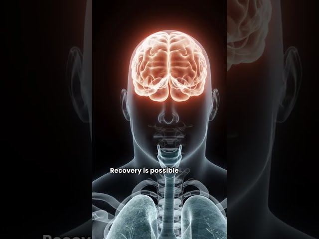 Functional Neurological Disorder (FND) Explained in Under 2 Minutes | Symptoms & Treatment