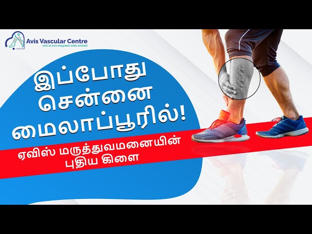Now in Mylapore, Chennai! Avis Hospitals – New Branch