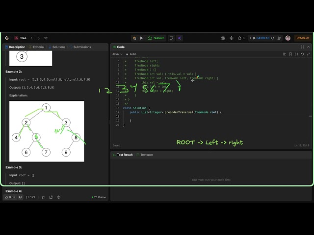 Binary Tree Preorder Traversal Iterative   Leetcode 144   Java
