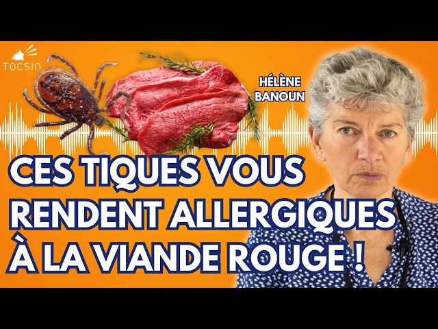 Tick Epidemic: The Worrying Statements by RFK Jr - Hélène Banoun