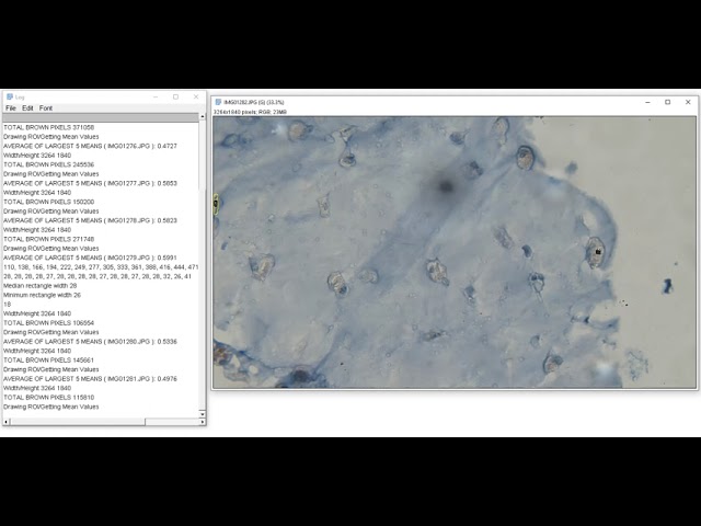 Running Collagen II Algorithm (EXPAND_OUT_AMOUNT = 6): Images 1275 - 1289 & 1456