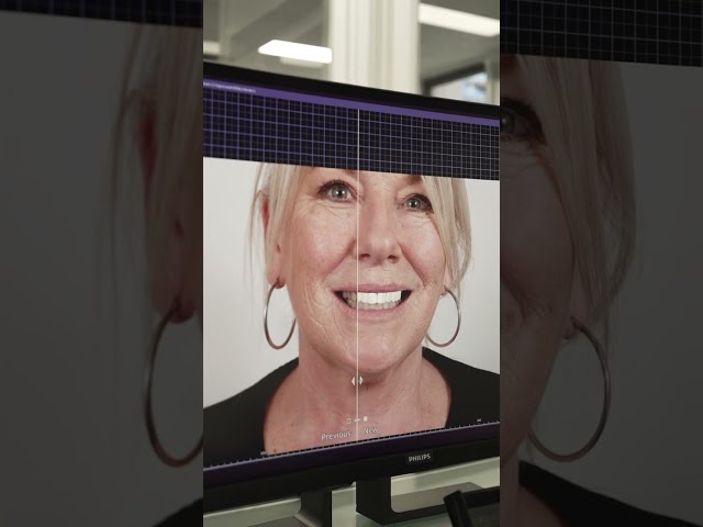 Creating your smile with Lead Ceramist Greg Karabasis at Smile Solutions Lab