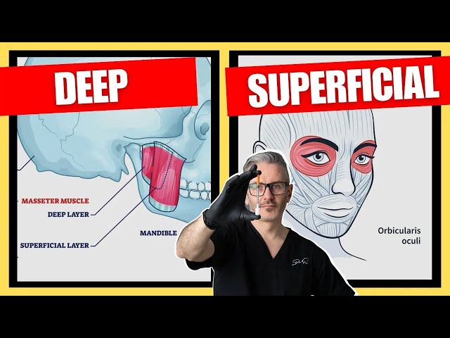 The Best Botox Injection Depths | Botox Injection Depth Guide