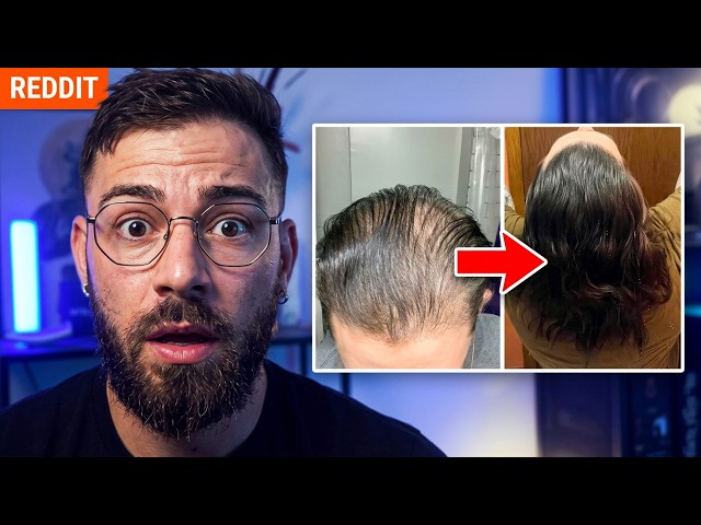 This Reddit Hair Comeback Took 3 Full Years
