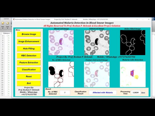 Automated Malaria Detection In Blood Smear Images Using Image Processing || IEEE Based Projects