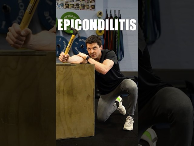 Epicondilitis: rutina real para dejar de tener dolor en el codo