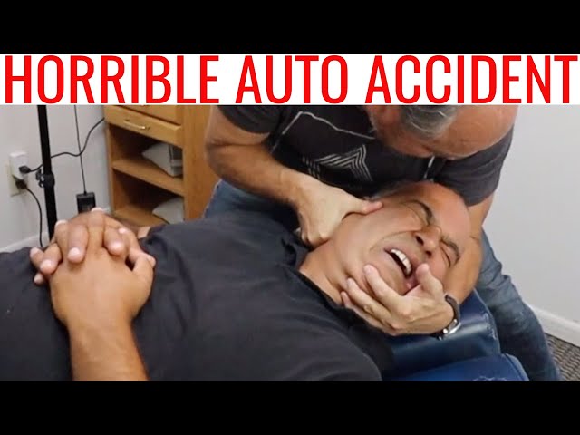 Concussion following Auto Accident treated by Chiropractor 1/2