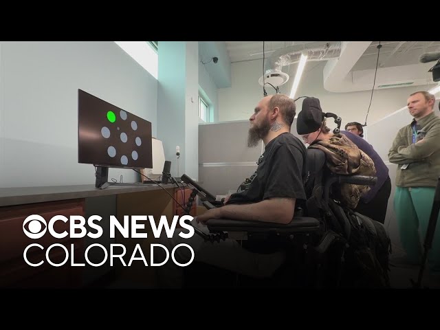 Colorado surgery first to implant higher-level brain computer interface