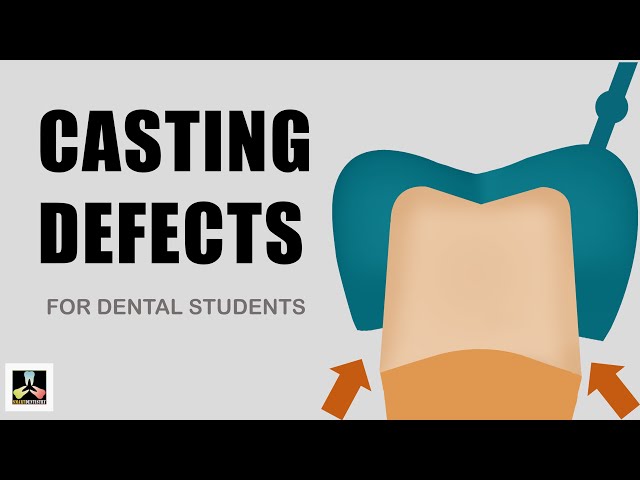 Dental Casting defects