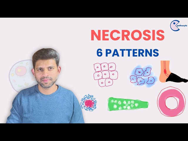 Patterns of Necrosis