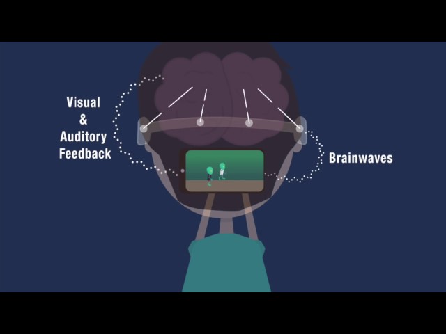 What is Neurofeedback/EEG Biofeedback?