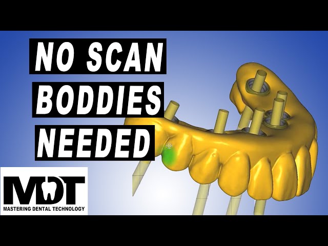 Exocad Design Tutorial for Screw retained Bar design on Ti Base implant abutment with Plovdiv 2.4