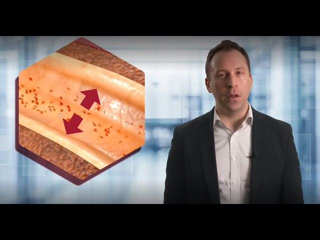 Definition and Diagnosis of Hypertension