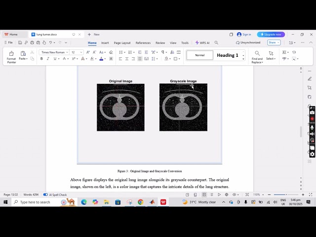 Lung Image Processing in MATLAB | Segmentation, Filtering & Active Contour Detection