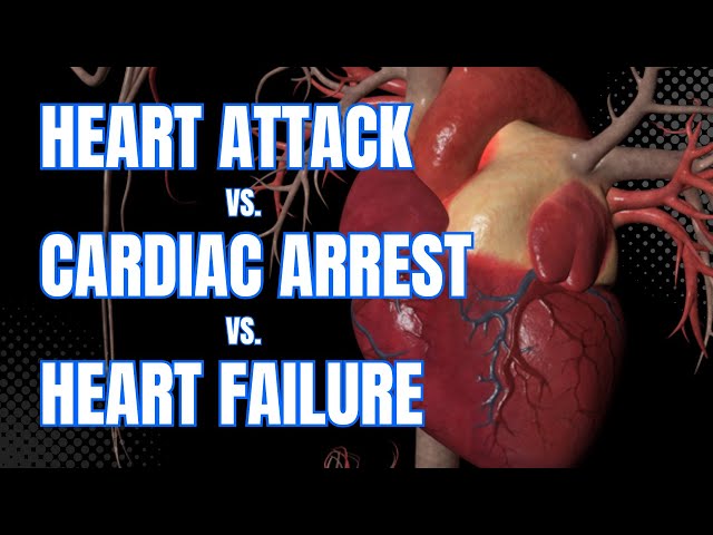 Cardiac Arrest vs. Heart Attack vs. Heart Failure